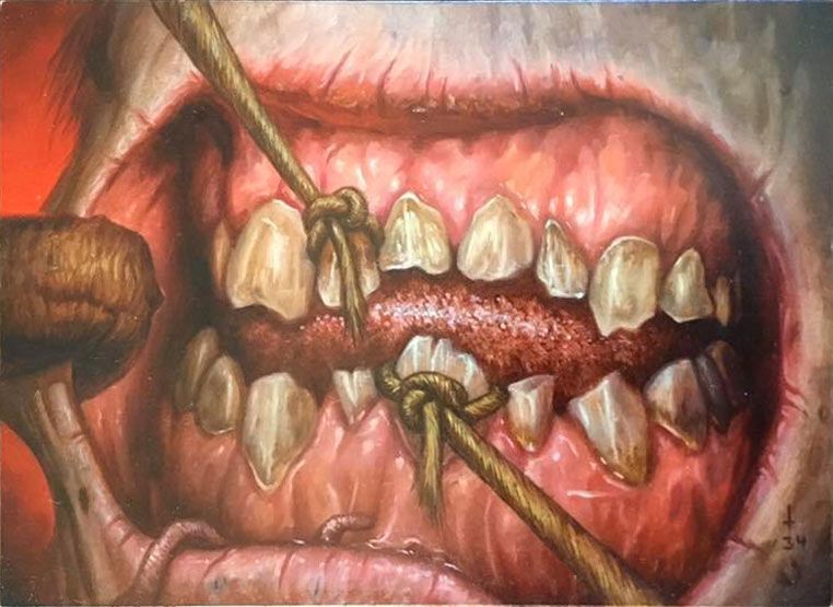 Pulling Teeth - Illustration by Jim Pavelec